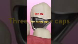 Ceramic cap for teeth 🪥🪥 [upl. by Lirrehs665]