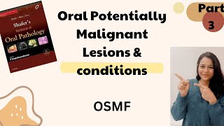 Oral Submucous Fibrosis  Oral Potentially Malignant Lesions amp Conditions  Oral Path  Part 2 [upl. by Aneram]