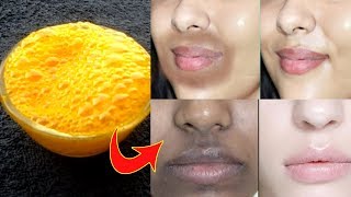 Remove Black Patches Around Mouth amp Forhead Upper Lips Skin Whitening Pack [upl. by Knipe271]