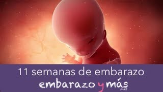 11 semanas de embarazo  Tercer mes  EMBARAZOYMAS [upl. by Varuag]