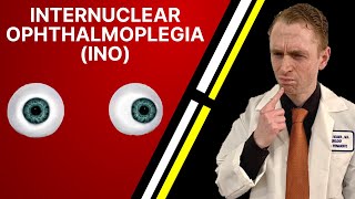 Neurologist Explains Internuclear Ophthalmoplegia INO [upl. by Rochelle729]