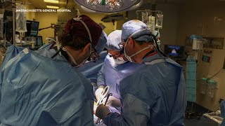 US surgeons transplant genetically modified pig kidney into patient in Boston [upl. by Karee]