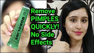 Remove PIMPLES amp ACNE IN 3 DAYS  NATURAL amp EASY METHOD [upl. by Katusha]