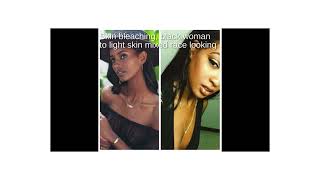 Skin Bleaching Black Woman Looks Mixed Race [upl. by Sredna]