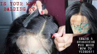 HOW TO REPLACE A LACE CLOSURE  FRONTAL ON A WIG EASY FIX  KENDRAS BOUTIQUE [upl. by Tjader]