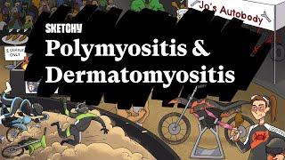 Path Study Guide Polymyositis amp Dermatomyositis  Sketchy Medical  USMLE Step 1 [upl. by Lecirg307]