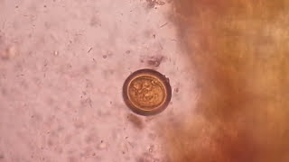 Egg of tapeworm or Taenia under the Microscope of saline preparation [upl. by Ahsenrac]