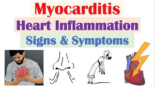 Myocarditis Heart Inflammation Signs amp Symptoms amp Why They Occur [upl. by Adnamas]