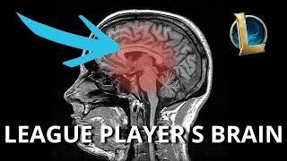 What League of Legends Does to Your Brain Its Not What You Think [upl. by Lymn70]