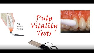 Pulp Vitality Test Thermal testsHeat Test Cold Test II NEETMDS [upl. by Akitnahs193]