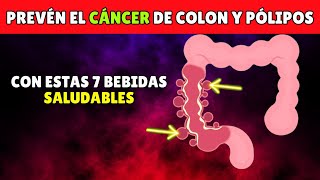 7 Bebidas SALUDABLES Para Prevenir el Cáncer de Intestino y los Pólipos de Colon [upl. by Joe]