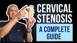 Cervical Spine Stenosis  A Complete Guide [upl. by Itnavart452]