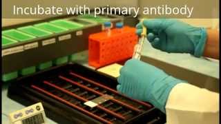 Immunohistochemistry  Procedure [upl. by Aleemaj173]