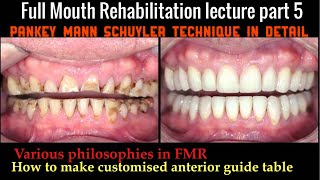 full mouth rehabilitation lecture part 5 [upl. by Ader]