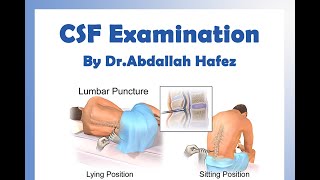 CSF EXAMINATION  PRACTICAL NEUROLOGY [upl. by Han]