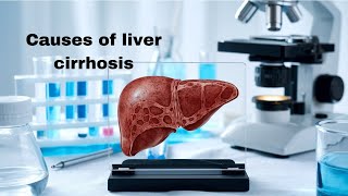 What causes liver cirrhosis Key risk factors explained [upl. by Reinke]