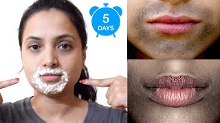 ಬಾಯಿ ಸುತ್ತಾ ಕಪ್ಪಾಗಿದ್ದರೆ ಇಲ್ಲಿದೆ ಮನೆ ಮದ್ದು  Remove Dark Spots Black Patches Around Mouth In 5 Days [upl. by Der]