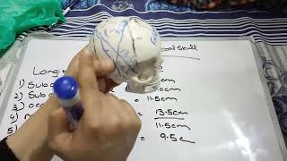 Diameter of fetal skull [upl. by Oglesby224]