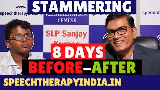 SLP Sanjay Kumar BeforeAfter Stammering Speech Therapy  Bangalore  Speech Pathologist India [upl. by Esinet]