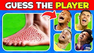 Who Got INJURY 😭🩸Football QuizComparison INJURY Moments of Football Player Messi Ronaldo [upl. by Nnairac]