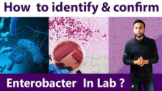 How to identify amp Confirm Enterobacter Bacteria at Lab [upl. by Christalle]