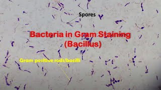 Bacillus Species Gram Stain Microbiology at various magnifications [upl. by Raffo]