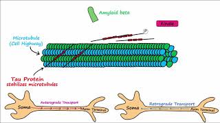 Alzheimers Disease  plaques tangles pathogenesis risk factors disease progression [upl. by Ilujna]