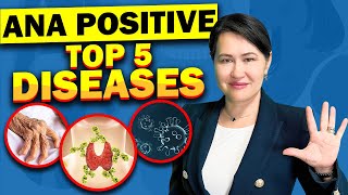 Top 5 Diseases with A Positive ANA Antinuclear Antibodies Test [upl. by Karlik]