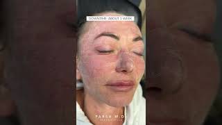 NonSurgical Skin Rejuvenation with Morpheus8 Co2 Laser  Dr Kami Parsa [upl. by Ylsew]