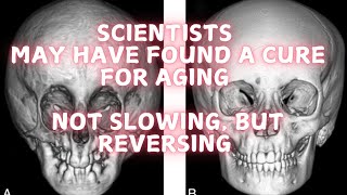 Scientists may have found a cure for aging [upl. by Assetan]