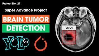 Project 27 Brain Tumor Detection Using YOLOv10  Train Yolov10 Object Detection l Custom Dataset [upl. by Anaik]