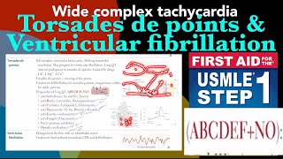 Torsades de point amp Ventricular fibrillation in HindiUrdu by first aid for USMLE step 1 [upl. by Oznofla496]