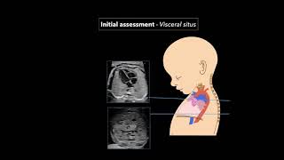 Fetal Echocardiography Protocol and Technique [upl. by Hannaj443]