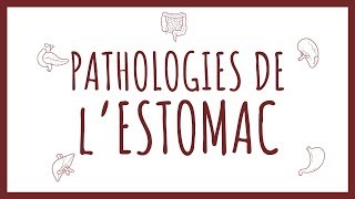 Sémiologie HGE  Pathologies Gastriques [upl. by O'Gowan]