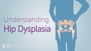 Understanding Hip Dysplasia  Boston Childrens Hospital [upl. by Wylma]