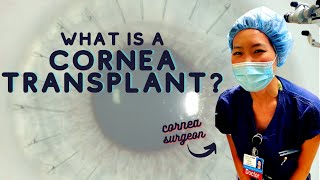 Cornea Surgeon Explains What is a Cornea Transplant  Top 3 Reasons For Cornea Surgery [upl. by Cirdek]