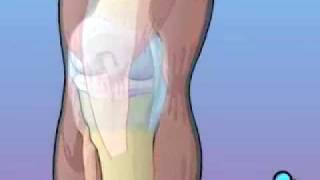 PreOp® Anterior Cruciate Ligament Patient Education [upl. by Elayor434]