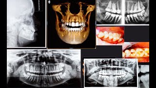 Radiologia nello Studio Dentistico [upl. by Llered]