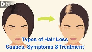 Types of Hair Loss  Common Causes Symptoms amp Treatment  Dr Kavitha GV Mandal [upl. by Merchant]