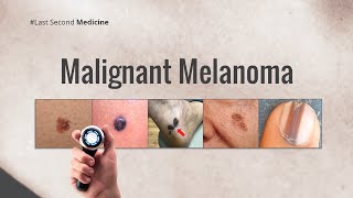 Malignant Melanoma [upl. by Eical509]