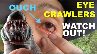 Bloodsucking leech in my eye 👁️ Cant get it out 🐛 [upl. by Notsniw]