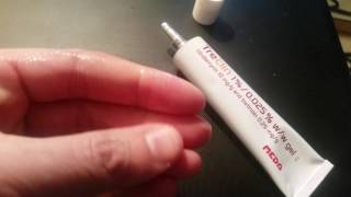 Acne medicine review  Treclin [upl. by Bois]