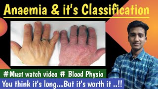 Anaemiaamp its Classification Blood PhysiologyLectures MBBS  in hindi Ashish [upl. by Atinas867]