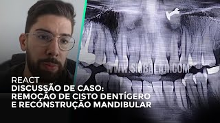 REMOÇÃO DE CISTO DENTÍGERO E RECONSTRUÇÃO MANDIBULAR  DISCUSSÃO DE CASO [upl. by Thunell]