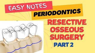 RESECTIVE OSSEOUS SURGERY  PERIODONTICS  Part 2  easy notes [upl. by Rooker]