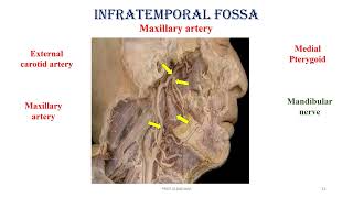 INFRATEMPORAL FOSSA [upl. by Sremlahc732]