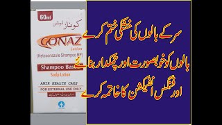 CONAZKETOCONAZOLESHAMPOO BASED LOTION USED FOR DENDRUF SEBORIC DERMATITIS FUNGAL INFECTION IN URDU [upl. by Licna]