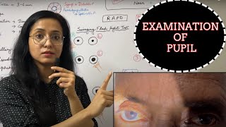 Examination Of Pupil  RAPD  Light Near Dissociation [upl. by Nuavahs]