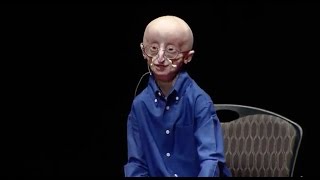 My philosophy for a happy life  Sam Berns  TEDxMidAtlantic [upl. by Babcock486]