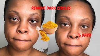 remove dark circles with tumeric in 5 days [upl. by Gerry]